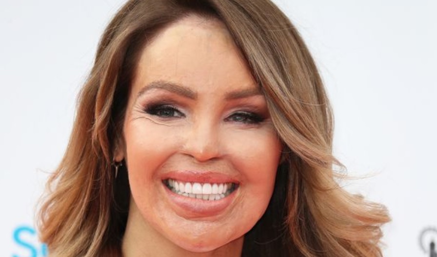 Katie Piper